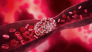 IISc. Develops Nanozyme to Prevent Excess Blood Clotting