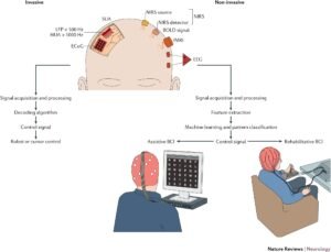 Brain–Computer Interfaces Explained