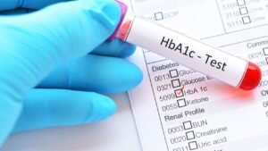 HbA1c Test