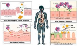 Staphylococcus aureus