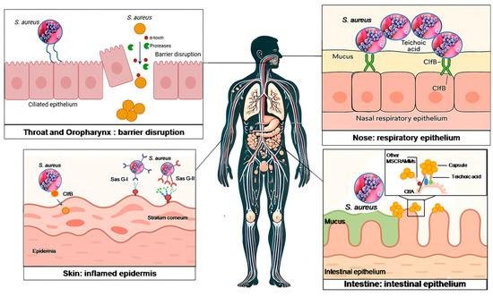 Staphylococcus aureus