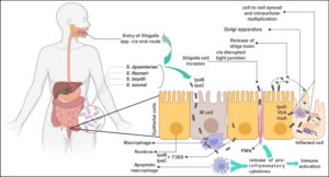 Shigellosis (Bacillary Dysentery): Causes, Transmission and Symptoms