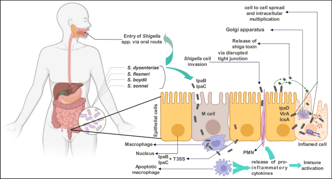 Shigellosis (Bacillary Dysentery): Causes, Transmission and Symptoms