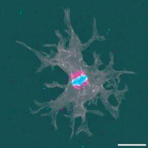 Incendiamoeba Cascadensis