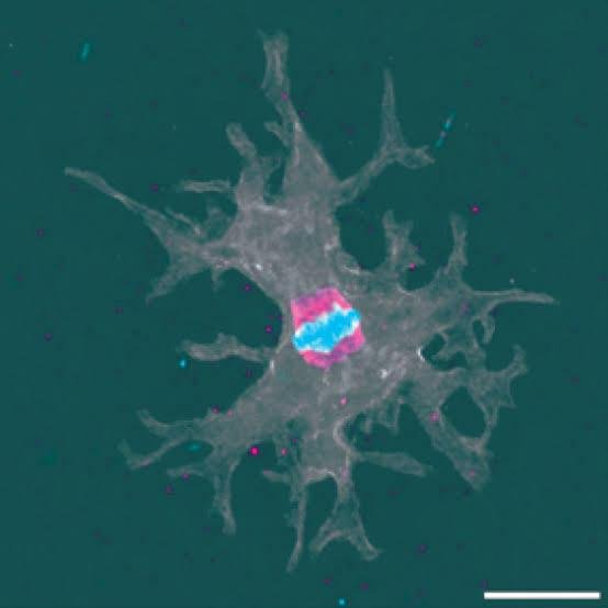 Incendiamoeba Cascadensis