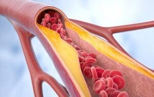 Arteries