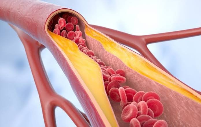 Arteries