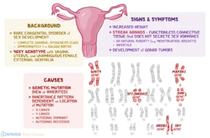 Swyer Syndrome